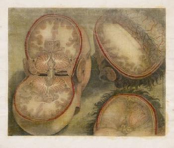 Zwei anatomische Studien: Drei Ansichten der Blutgefäße im menschlichen Schädel (1); Ansichten des Kopfes mit Rückenmark und Gehirn (2) by 
																	Jacques Fabien Gautier d'Agoty
