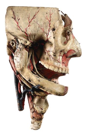 A Detachable Anatomic Head by 
																	Louis Thomas Jerome Auzoux