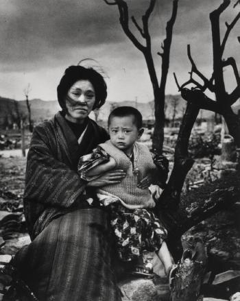 Mother and Child, Hiroshima by 
																	Alfred Eisenstaedt